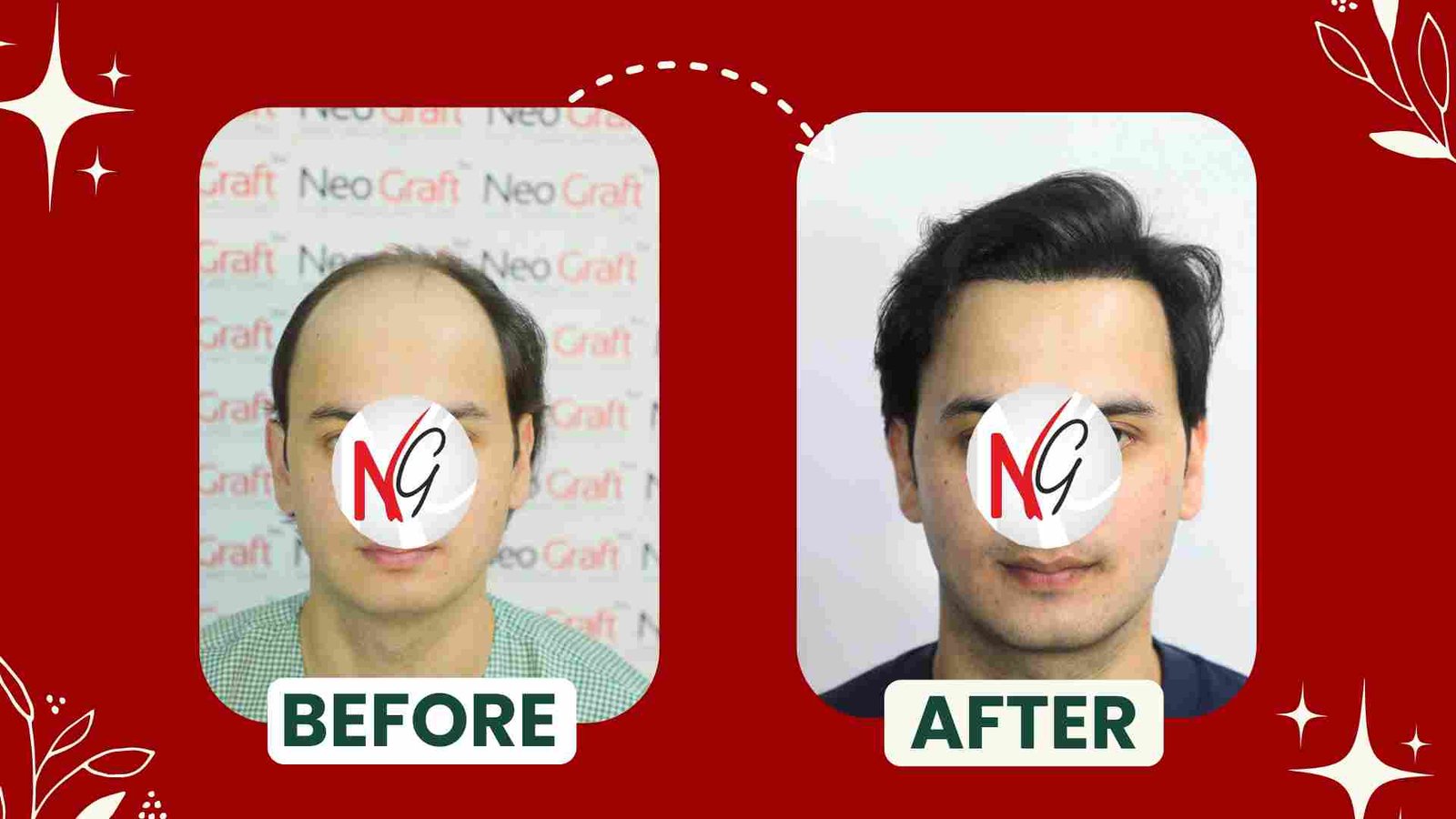 before after
